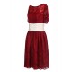 Short Sleeve Lace Knee-Length Mother of the Bride Dresses M010011